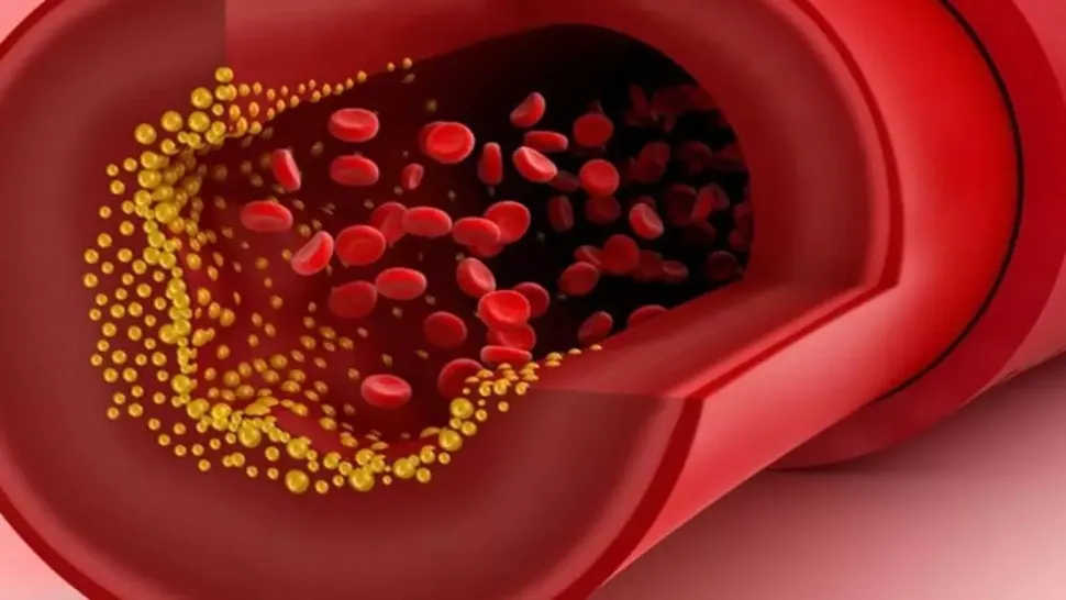 Alimente care scad colesterolul: soluții naturale pentru o inimă sănătoasă