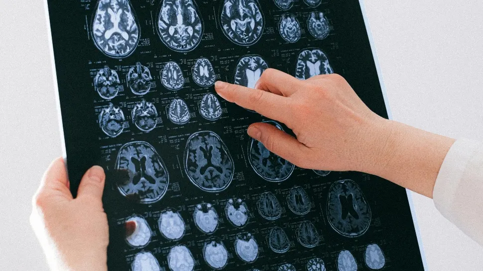 Premieră medicală la Londra: prima operație de creier asistată de inteligență artificială i-a salvat vederea unui bărbat