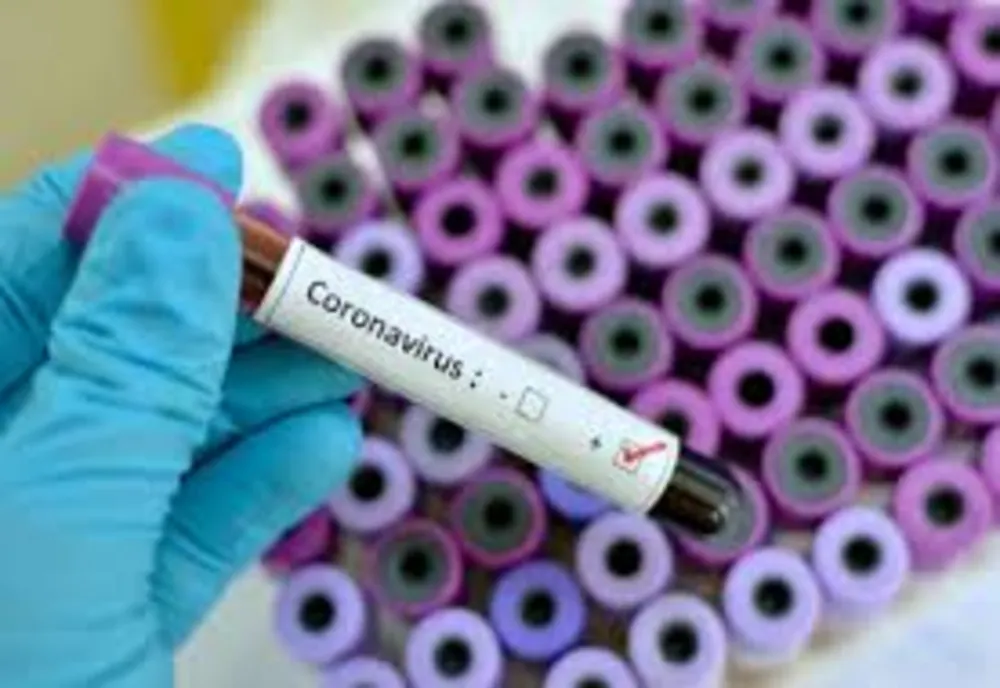 Unde pot face românii teste pentru depistarea coronavirusului