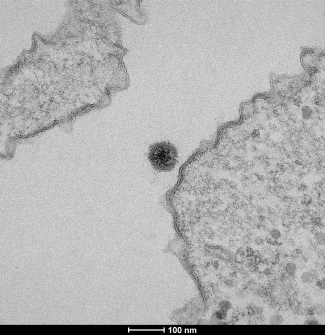 Oamenii de știință au descoperit recent un virus nou-nouț - YARAVIRUS.