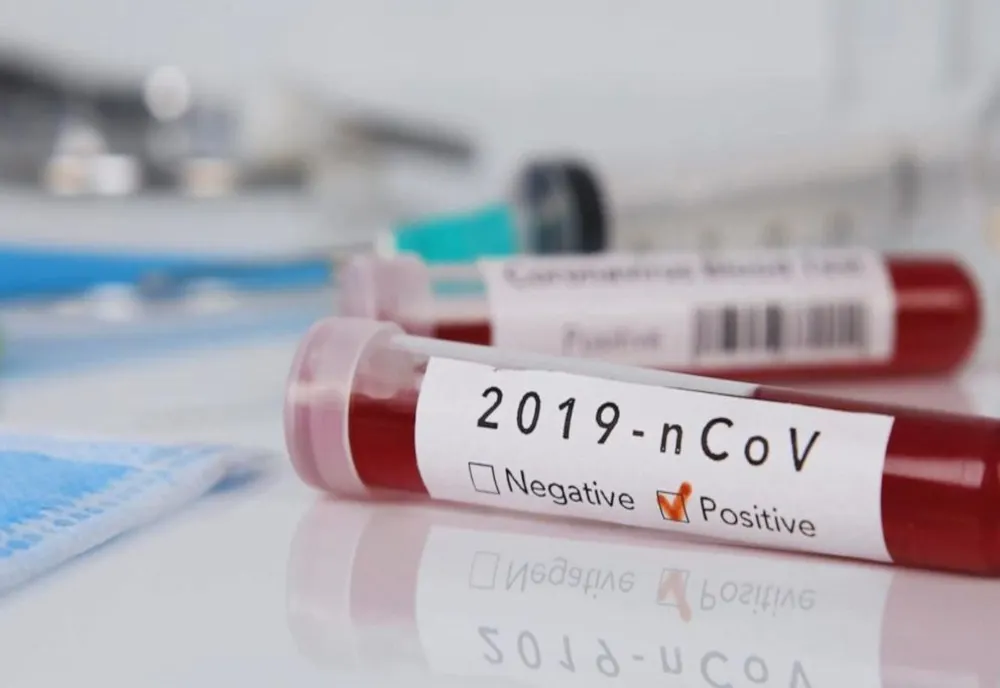 Israelul a testat cu succes două medicamente împotriva COVID-19