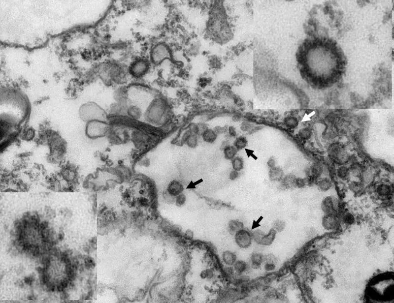 A fost descoperită o nouă tulpină de coronavirus. Oamenii de știință spun că ar putea fi mai contagioasă decât cea originală.