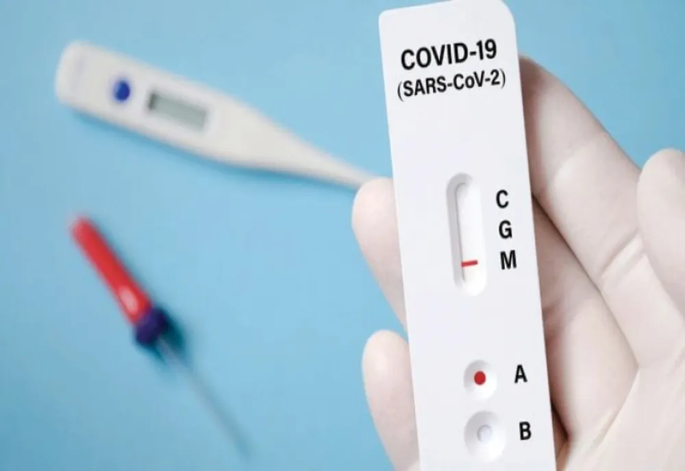 Testarea rapidă în farmacii pentru depistarea COVID-19, aprobată de Ministerul Sănătății 