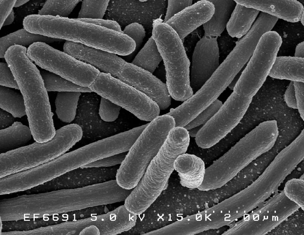 Infecția cu Escherichia coli (E.coli)