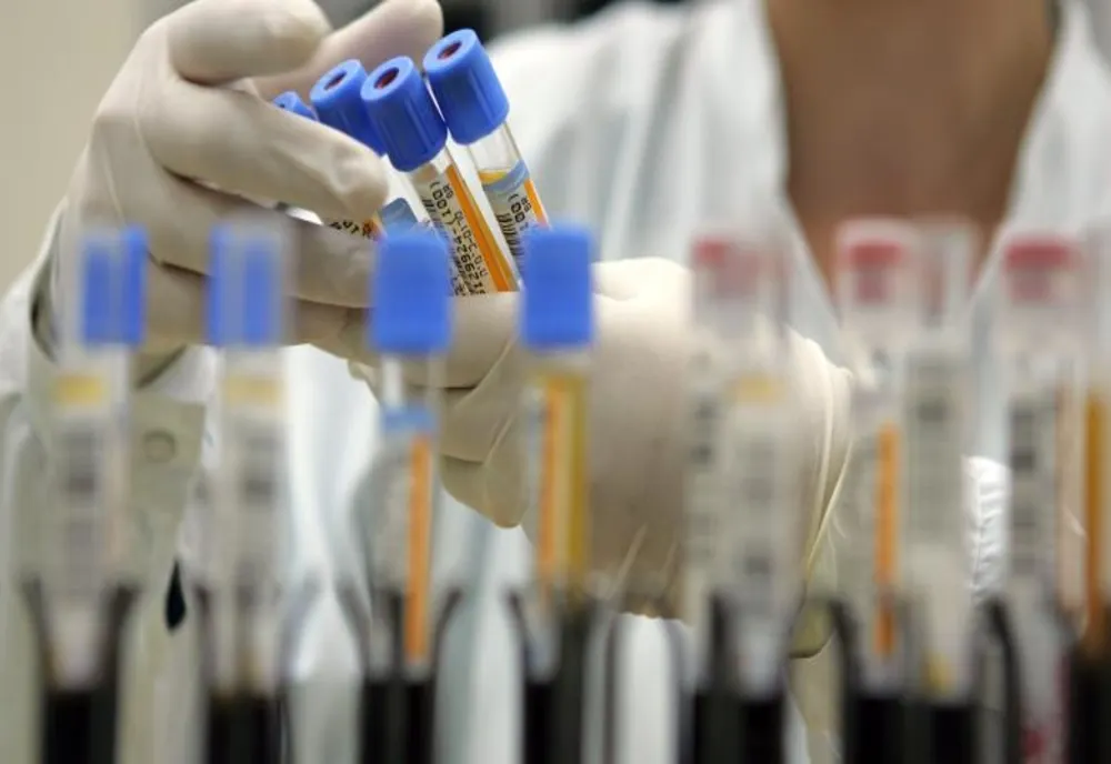 CAMPANIE GRATUITĂ DE TESTARE HPV LA SCJU TÂRGU MUREȘ PENTRU FEMEILE ÎNTRE 25 ȘI 65 DE ANI