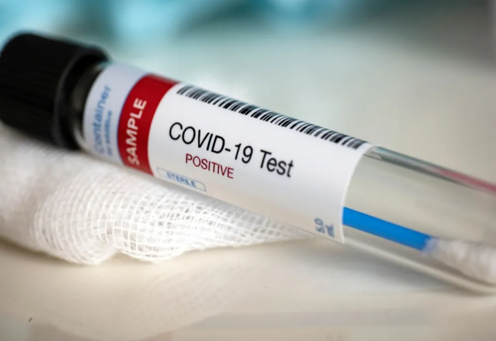 INSP: PESTE 1. 000 DE CAZURI NOI DE PERSOANE INFECTATE CU SARS-CoV-2