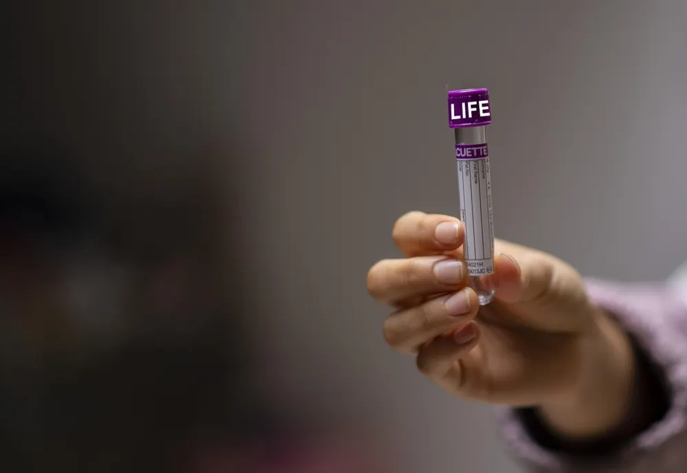 Descoperire medicală uriașă. Un test rapid depistează hepatita C în 15 minute, direct în cabinet