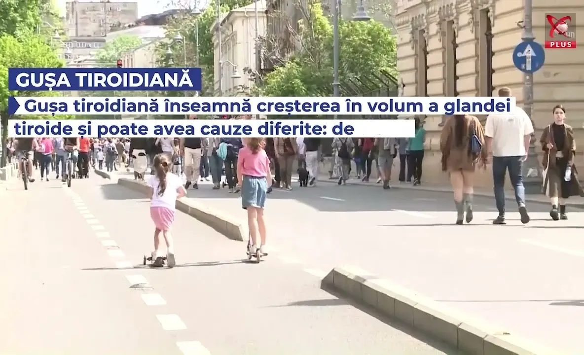 Ce se întâmplă când glanda tiroidă devine vizibilă la nivelul gâtului