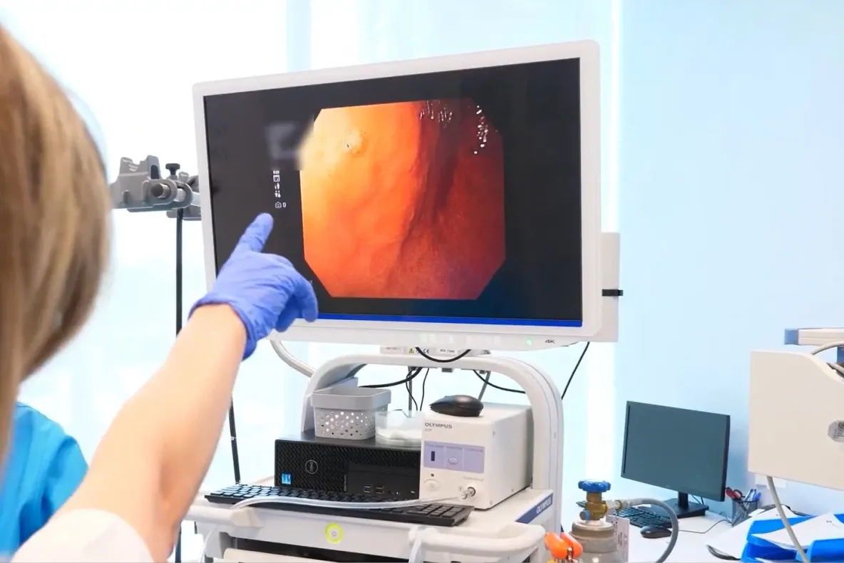 Rolul colonoscopiei in diagnosticul și prevenția cancerului de colon