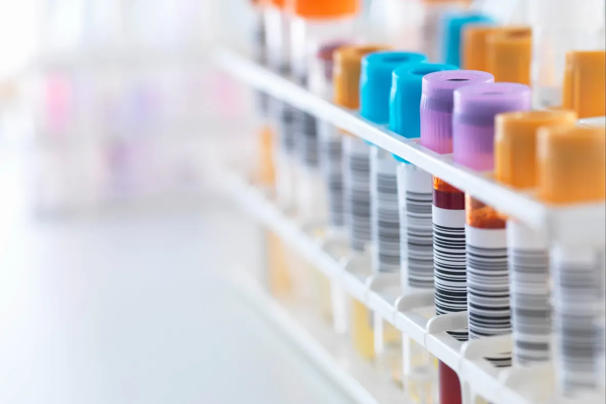 România, printre țările europene cu cele mai multe diagnostice HIV tardive