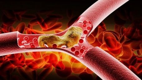 Alimentul banal care ajută la scăderea colesterolului