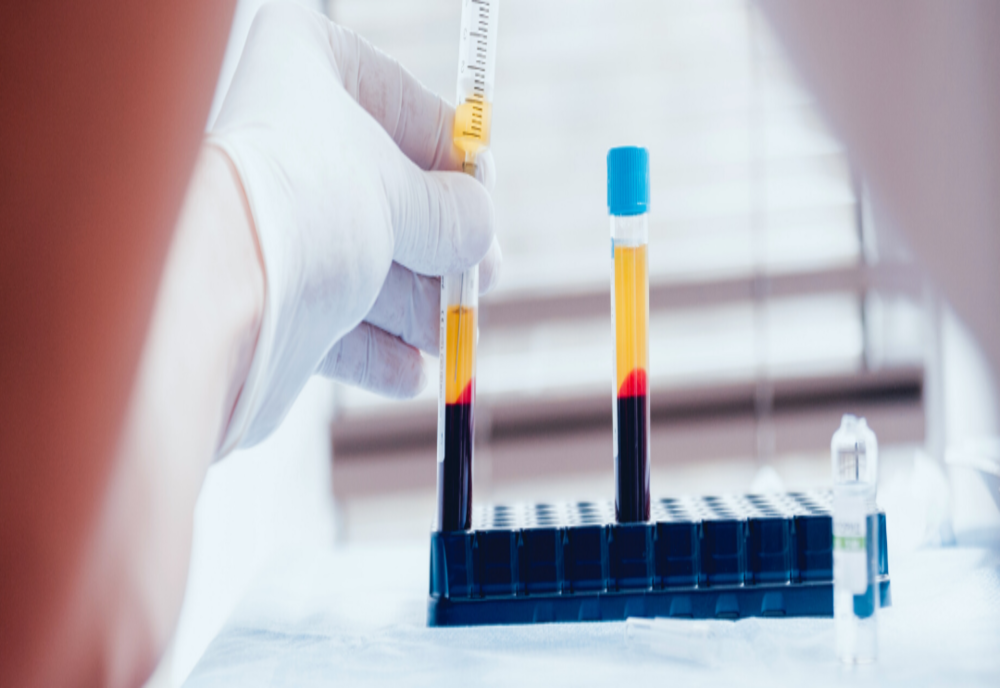 Pacientii infectati cu COVID-19 care au primit plasma se simt mai bine, spun medicii