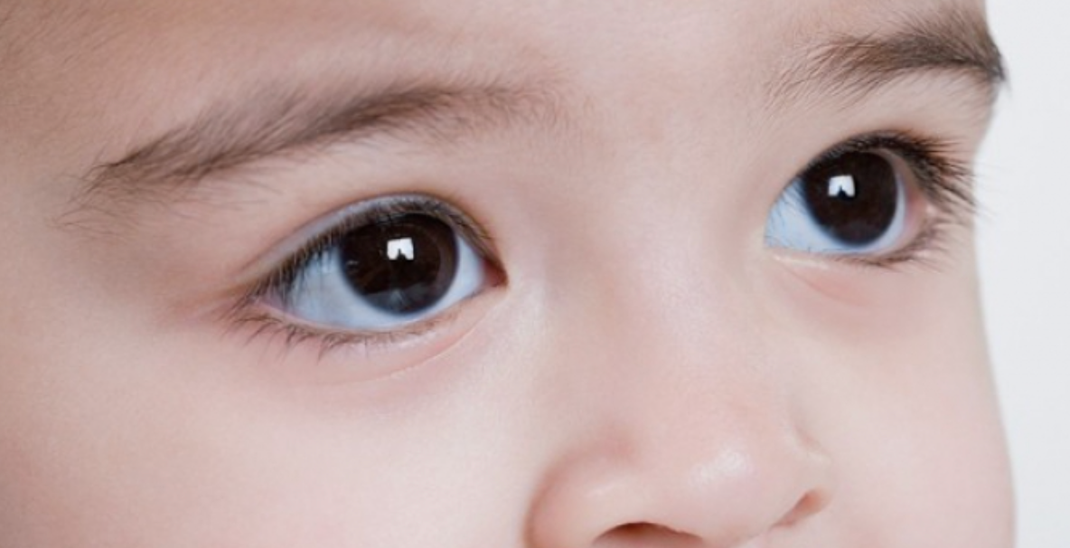 Cum să ai grijă de OCHII COPILULUI TĂU