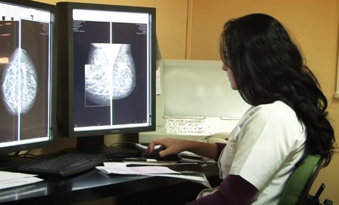 Mamografia şi/sau ecografia mamară
