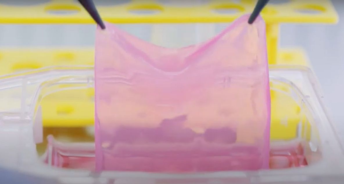 Elveţia a dezvoltat primul aparat care produce piele pentru transplanturi