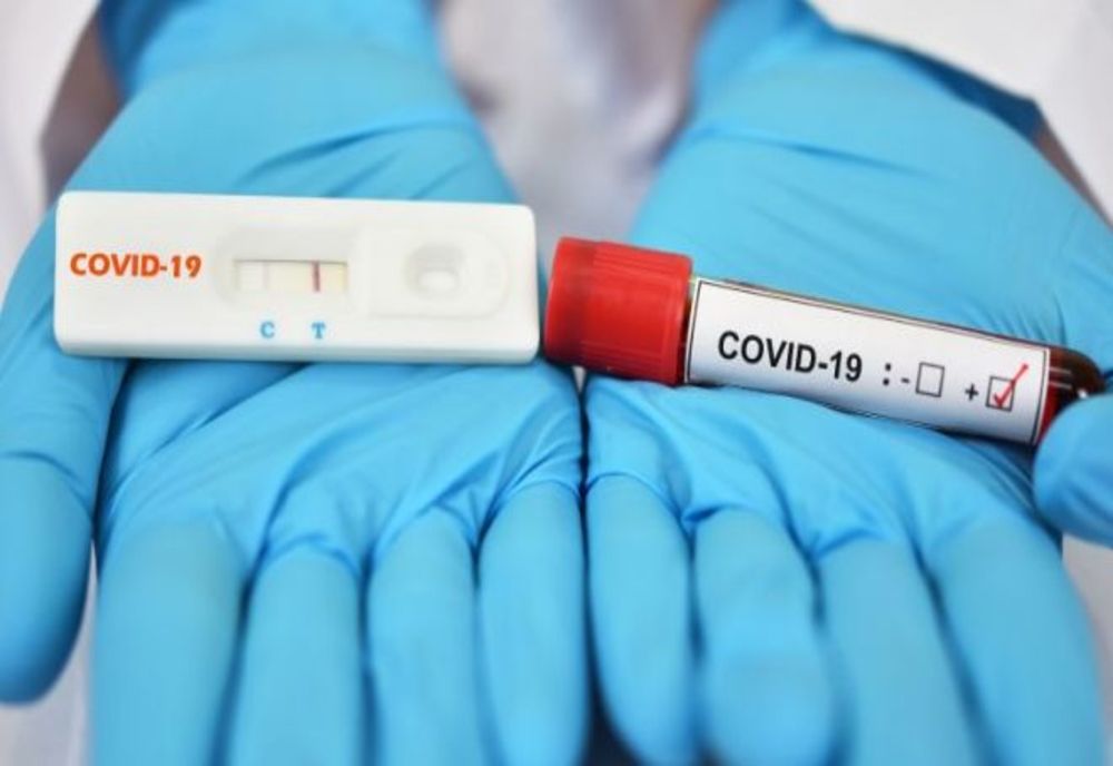 REGULI NOI pentru testarea Covid-19 la domiciliu, în Bucureşti