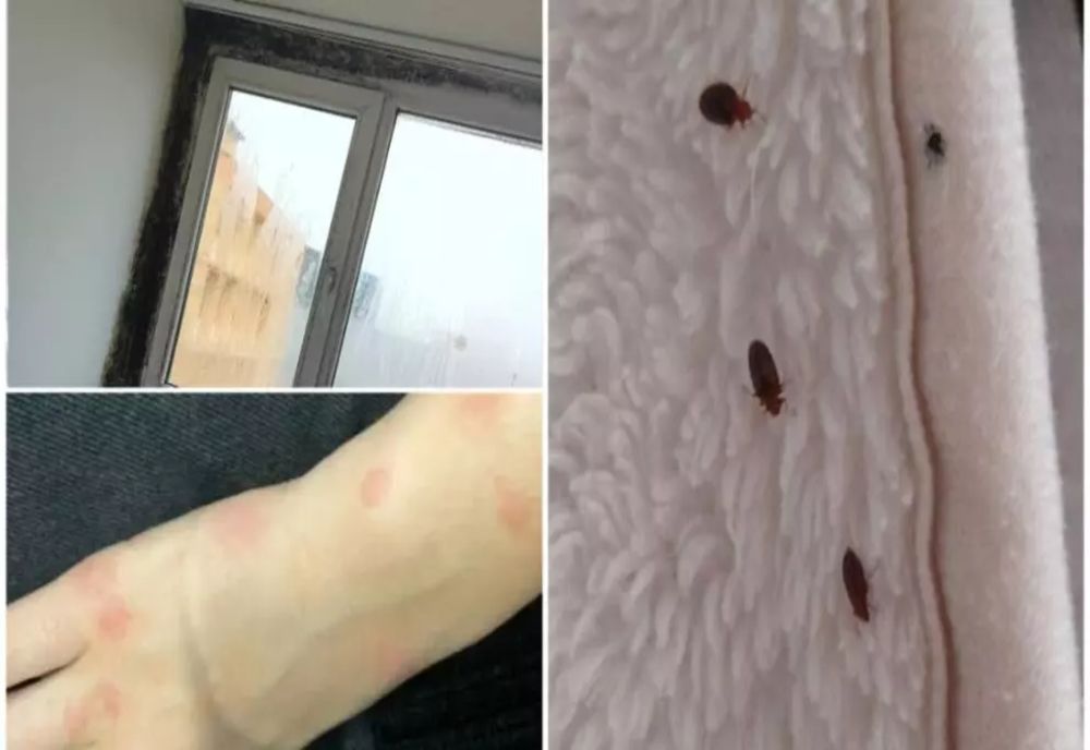 Invazie de ploșnițe! Cum recunoști mușcătura și ce trebuie să faci imediat ca să scapi de ele