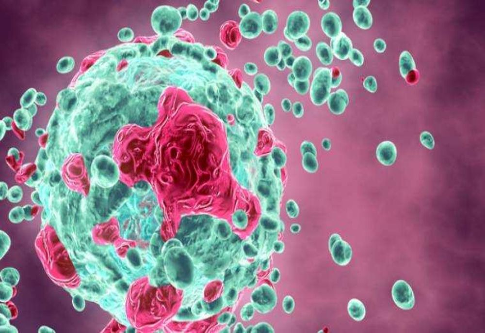 TEST GENETIC REVOLUȚIONAR ÎN MAREA BRITANIE: SCHIMBĂ DIAGNOSTICUL ȘI TRATAMENTUL PENTRU MIELOMUL MULTIPLU