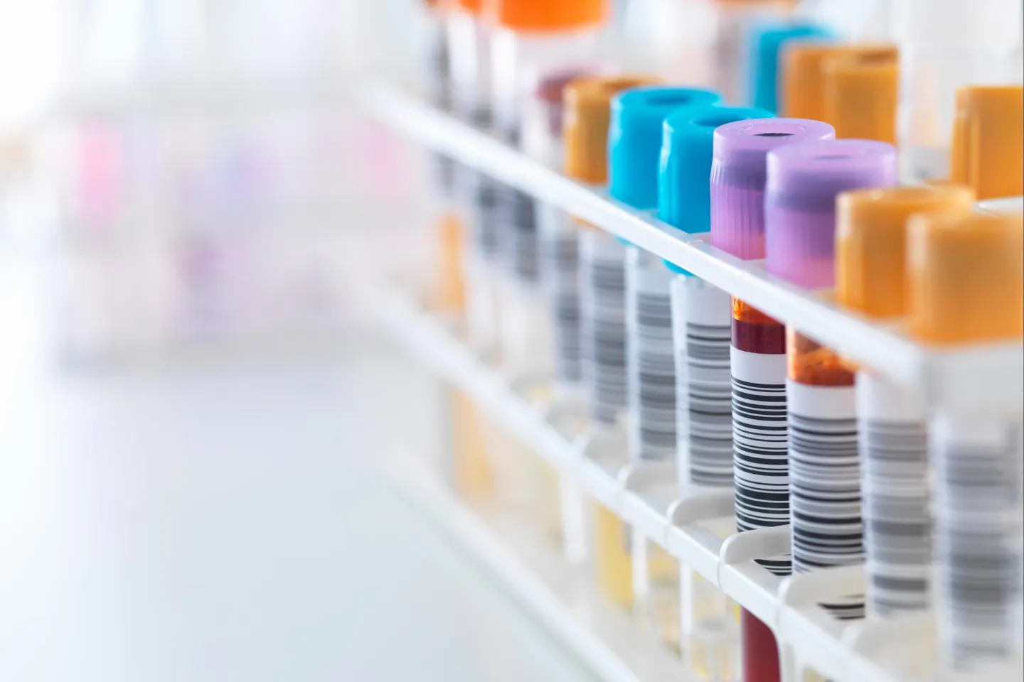 România, printre țările europene cu cele mai multe diagnostice HIV tardive