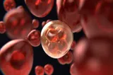 Un simplu test de urină poate depista cele mai multe cazuri de cancer de vezică urinară