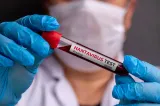 Hantavirus: ce este, cum se transmite și cum se previne