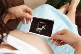 Primele simptome ale sarcinii: semne care pot apărea încă din primele săptămâni