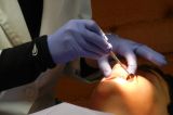 Sensibilitatea dentară: de ce apare și cum poate fi prevenită
