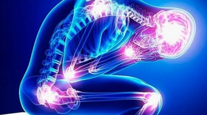 fibromialgia