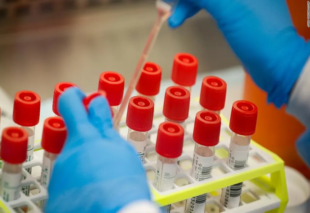 Cercetătorii au descoperit șapte mutații ale coronavirusului în timpul unei analize a testelor COVID-19