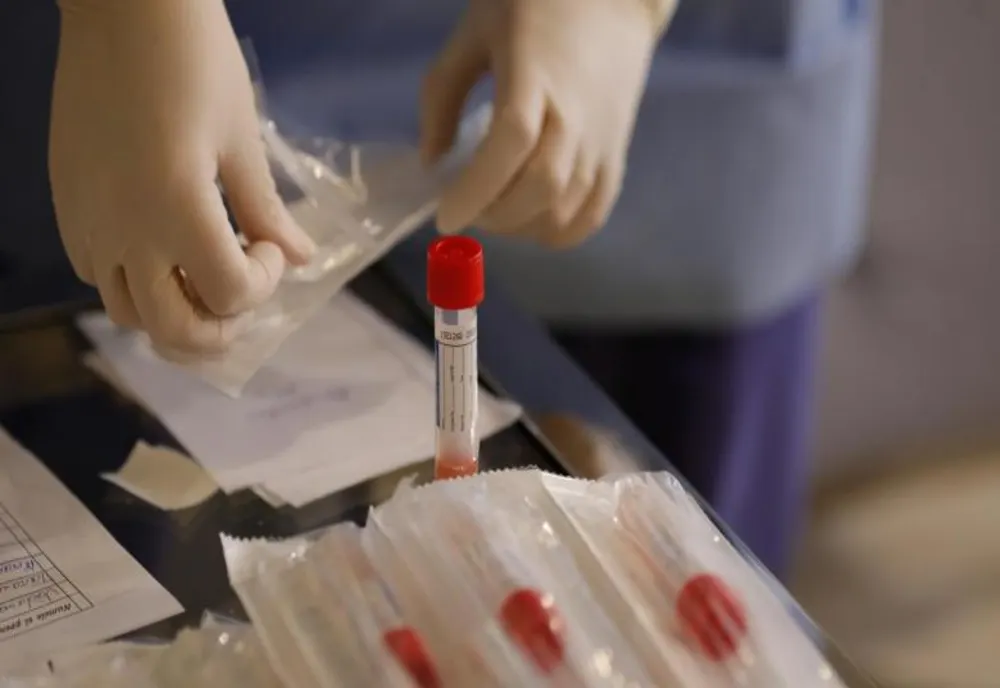 România crește capacitatea de testare COVID