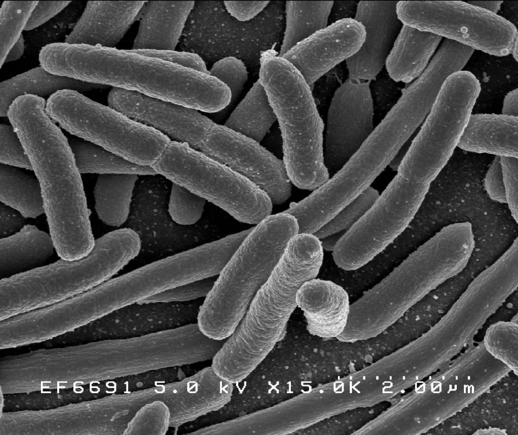 e_coli