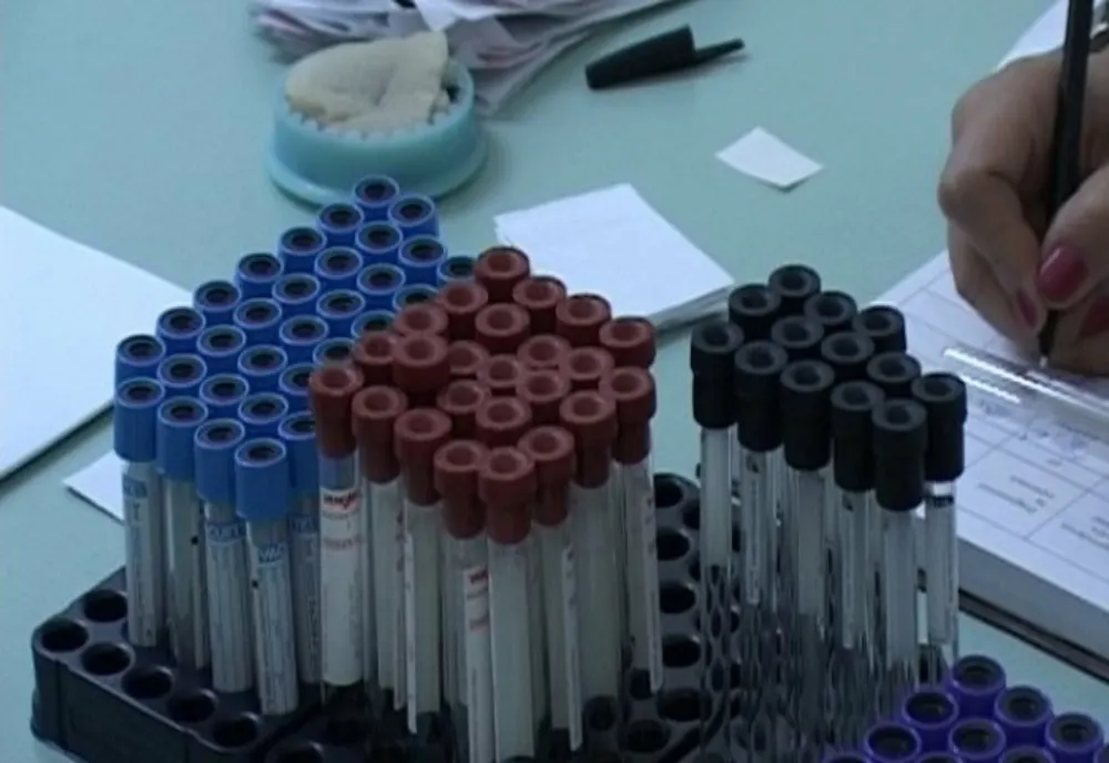 Un simplu test de sânge poate arăta ce pacienți vor muri de COVID