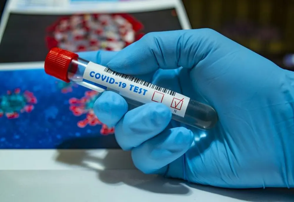 Bilanț coronavirus - 9 mai: 385 de cazuri noi și 4 decese. Câți români sunt INTERNAȚI în spital