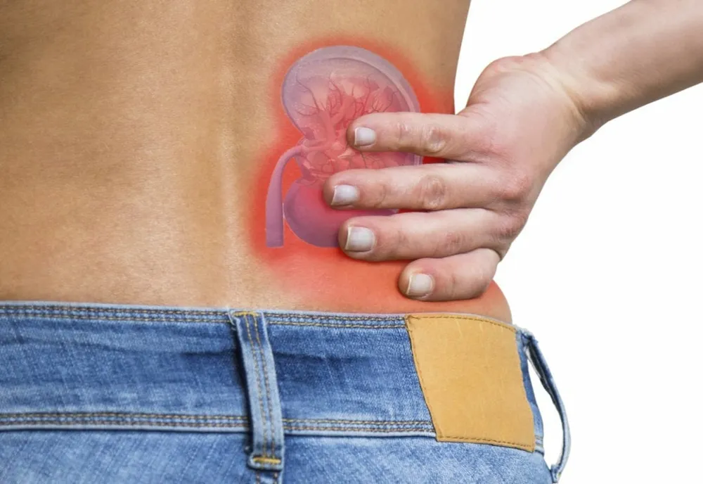 Pietrele la rinichi – de ce apar si cum le prevenim?
