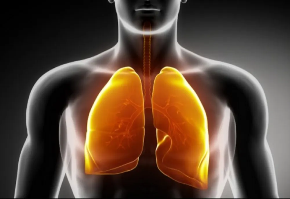 Pneumonia, o infecție ce nu trebuie ignorată