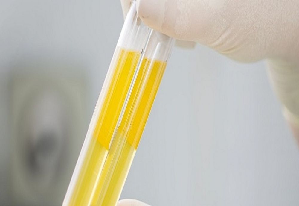 Tratamentul cu plasmă REDUCE rata mortalității!