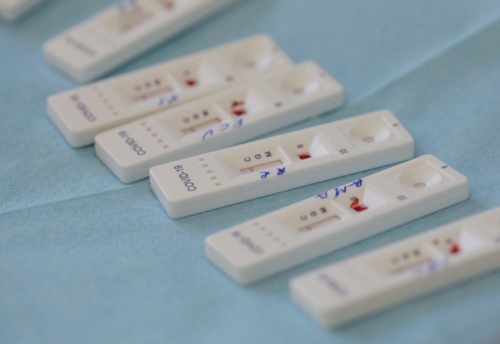 Testul rapid COVID-19 Antigen, dezvoltat și produs de o companie 100% românească! Rezultat în doar 15 minute