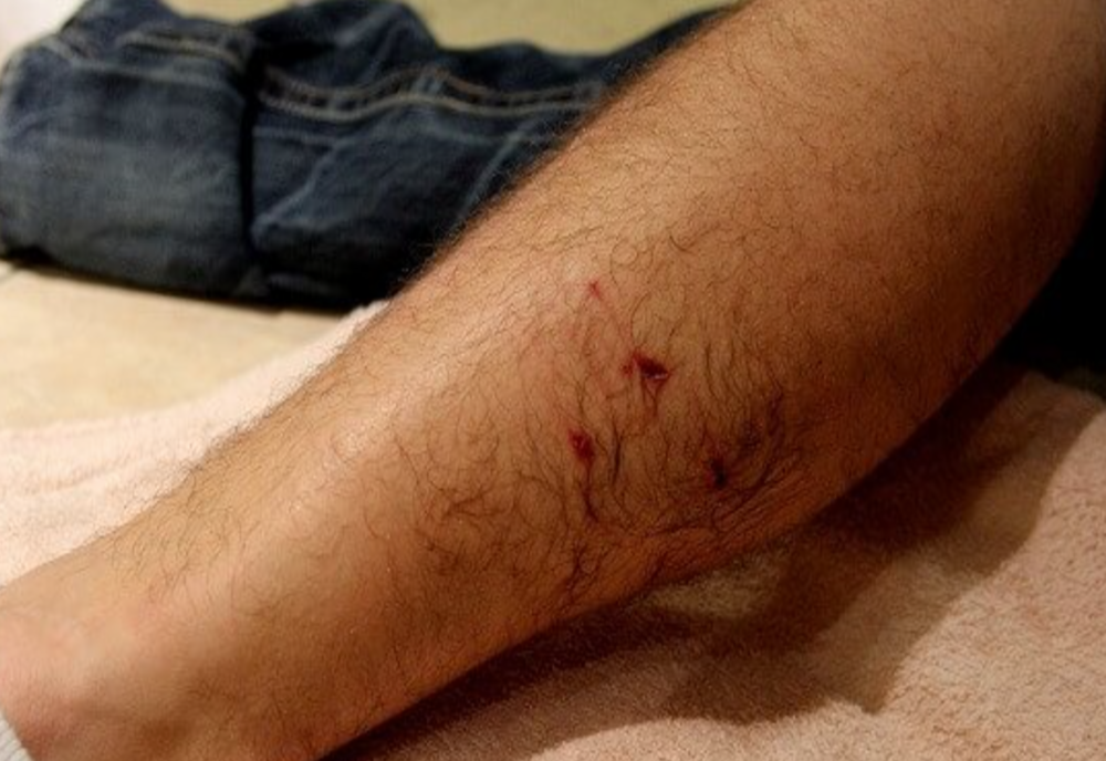 Primul ajutor în cazul mușcăturilor de animale