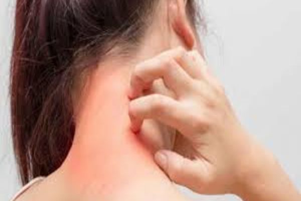 Primul medicament pentru cea mai întâlnită alergie