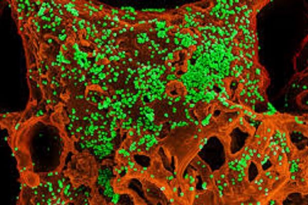 Cât timp pot supraviețui coronavirusurile pe diferite tipuri de suprafețe?