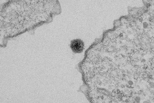 Oamenii de știință au descoperit recent un virus nou-nouț - YARAVIRUS.