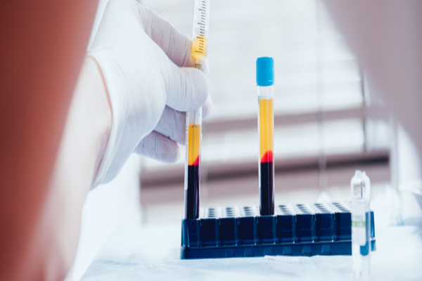 Pacientii infectati cu COVID-19 care au primit plasma se simt mai bine, spun medicii