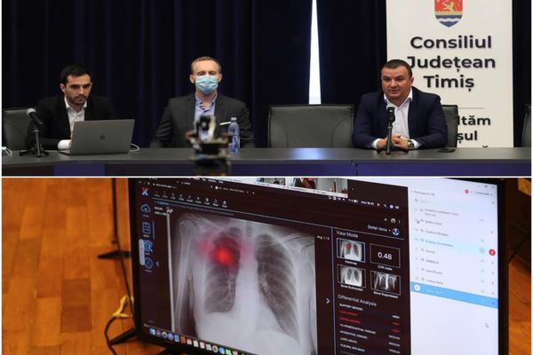 Inteligenţa artificială, în spitalele din judeţul Timiș, pentru depistarea a 17 patologii ale aparatului respirator