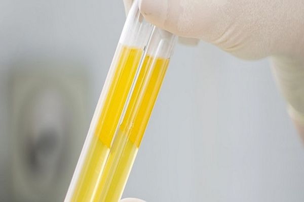 Tratamentul cu plasmă REDUCE rata mortalității!