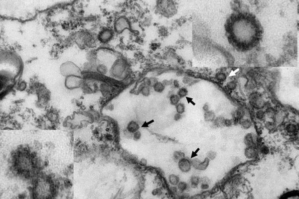 A fost descoperită o nouă tulpină de coronavirus. Oamenii de știință spun că ar putea fi mai contagioasă decât cea originală.