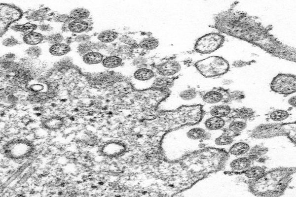 Cercetătorii americani au descoperit o mutație care sporeşte capacitatea de infecţie a virusului SARS-CoV-2