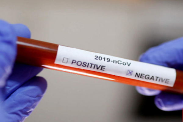 Cazuri noi de coronavirus la ISU Giurgiu și la Ambulanță