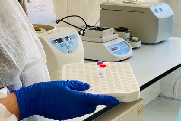 STUDIU: Pacienţii vindecaţi de COVID-19 pot avea încă virusul în sistemul digestiv, chiar şi în absenţa simptomelor