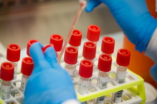 Cercetătorii au descoperit șapte mutații ale coronavirusului în timpul unei analize a testelor COVID-19