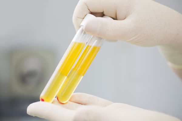 Peste 2.500 de români vindecați de COVID au donat plasmă pentru salvarea pacienților infectați